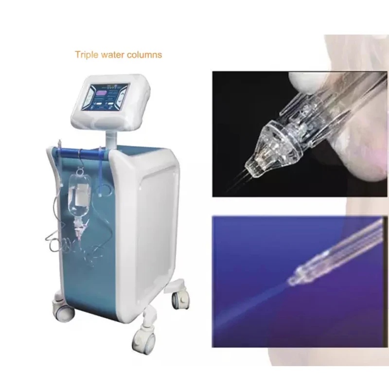 Mesin injeksi mesodermal tanpa - Tech Accessories Uk ulasan dan harga
